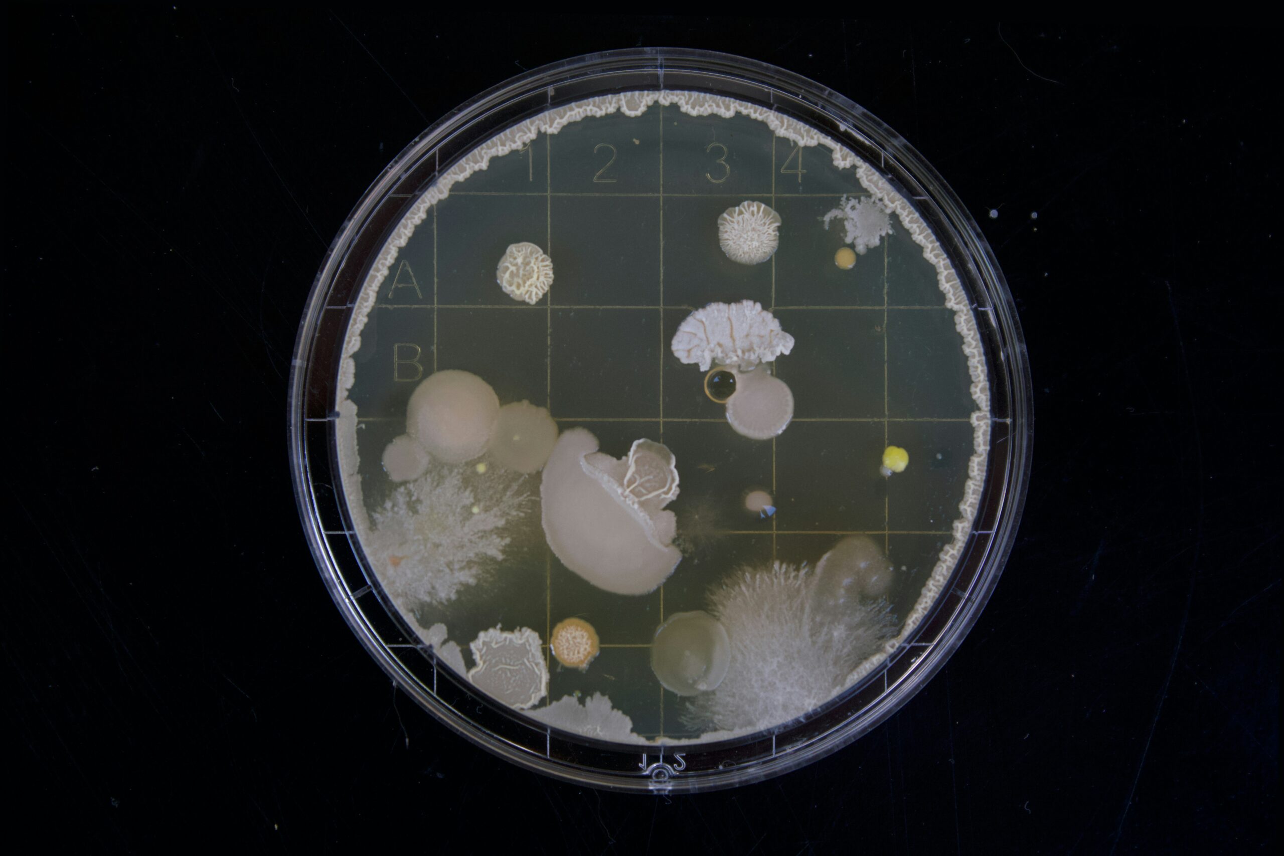 bacterial culture